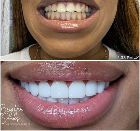 kookooforcocopuffs onlyfans leaks porn