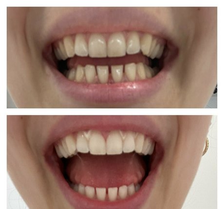 zoenafree onlyfans leak nude