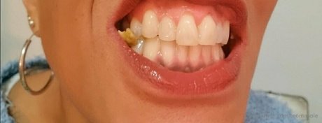 teomasole onlyfans posts