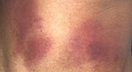 DOLLY GIRL nude leaks onlyfans