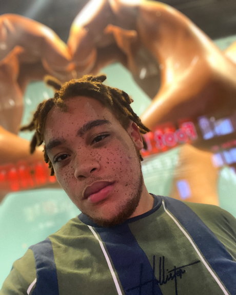 Freckles onlyfans star