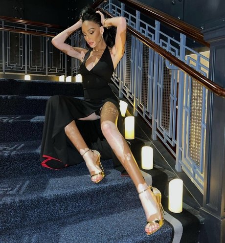 Winnie Harlow onlyfans photo