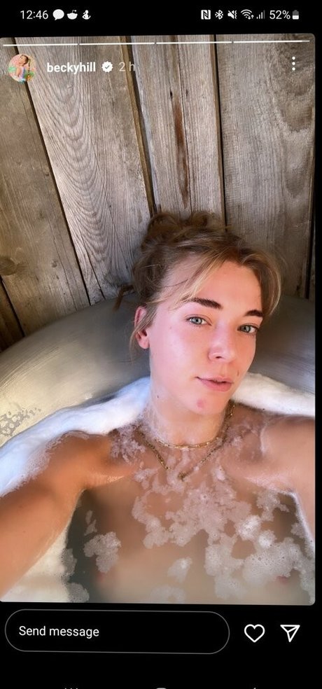 Becky Hill leaked onlyfans pics