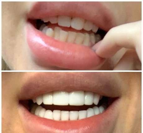 toobadforyou only fans leaked