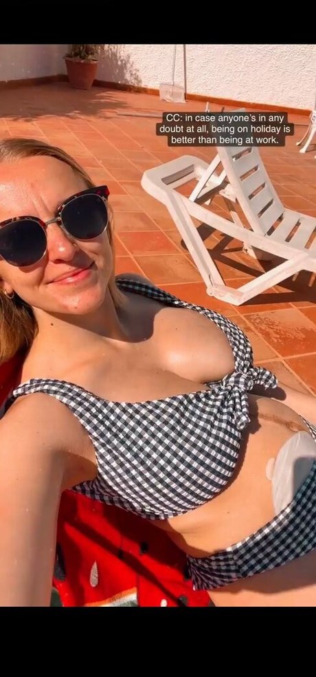 Hannah Witton onlyfans leak
