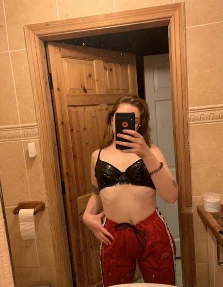 freckle fox leak only fans