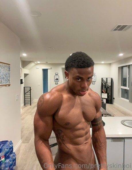 prettyskinboi  negative