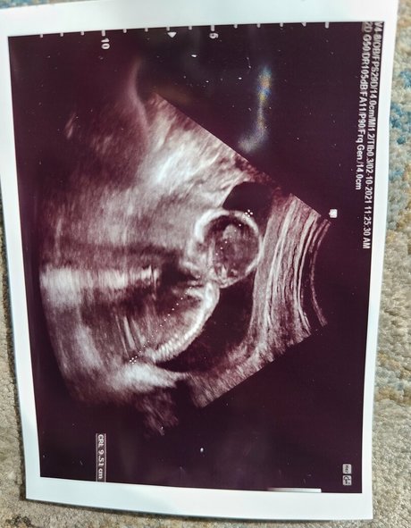 goodluckanne onlyfans nude photos