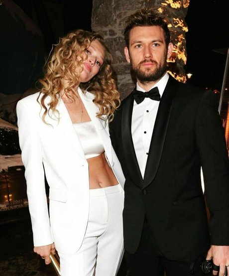 Toni Garrn onlyfans leake