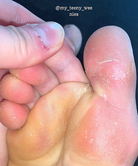 my teeny weenies onlyfans nudes