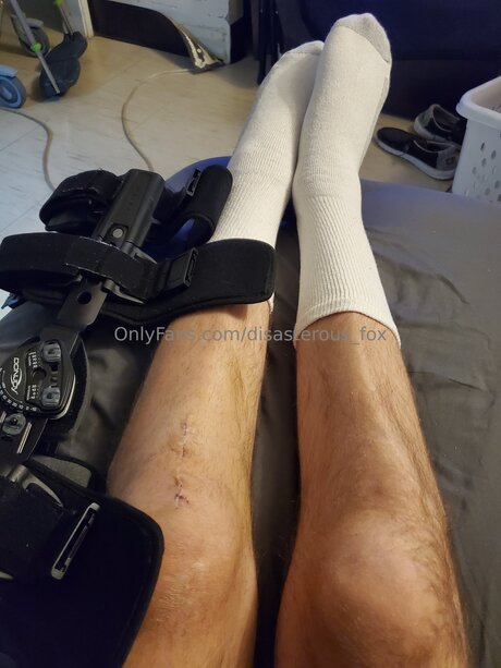 Disasterous Fox only fans pics