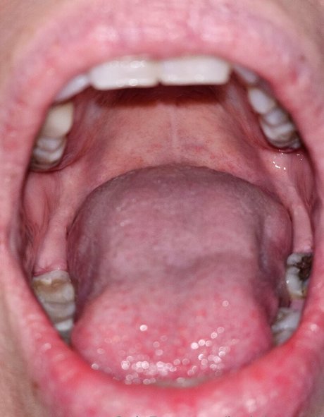 jackdaspeck xxx onlyfans