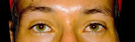 Alan Meyer_ nude leaked onlyfans