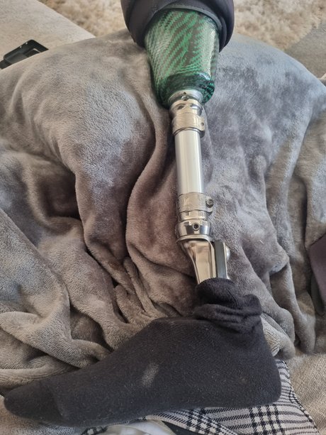 Stumpy porn onlyfans