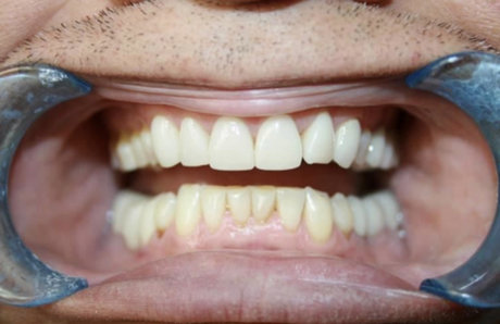 ToothFetish Doc onlyfans leakes