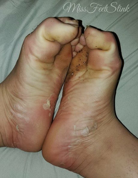 missfeetstinkvip onlyfans nudes