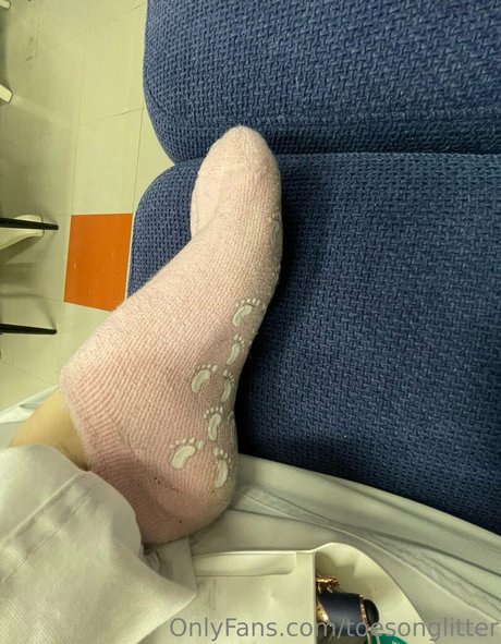toesonglitter only fans free