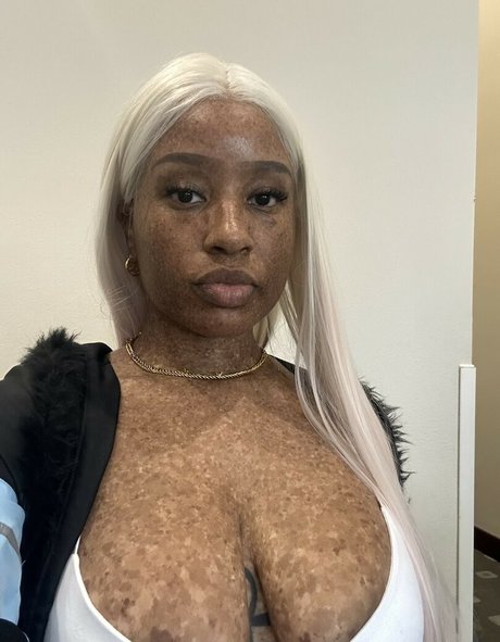 freckledn naked onlyfans leaks