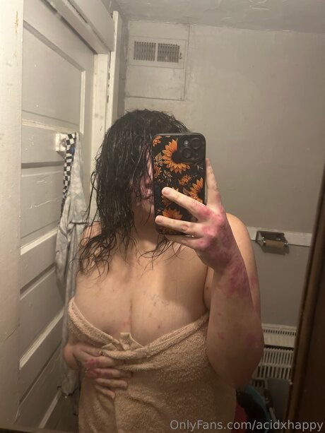 Acidxhappy onlyfans leak free