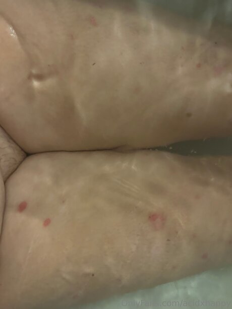 Acidxhappy nude on onlyfans