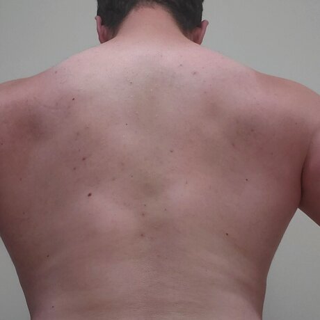 Andrew dennis fans only