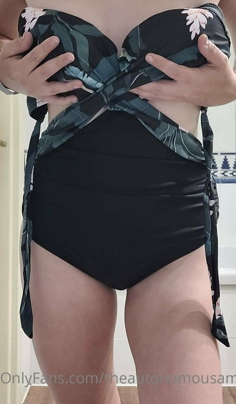 theautonomousamputee2 new onlyfans leak