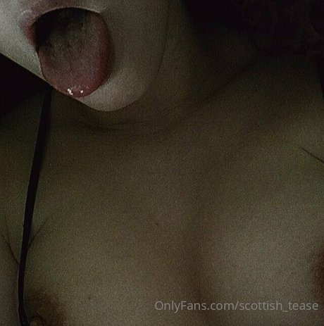 scottish tease leaked only fans