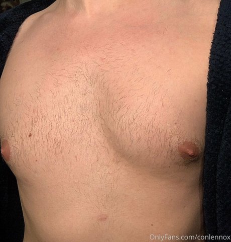 conlennox leak only fans