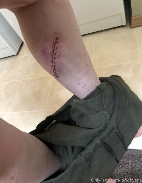 lewdhyena onlyfans leaks