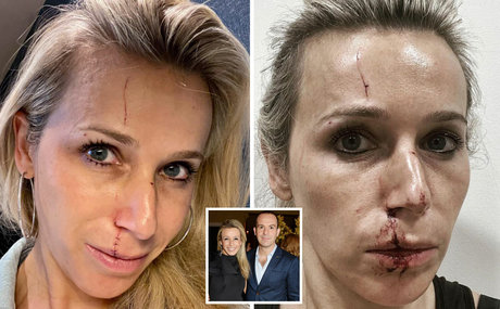 Lara Lewington leak onlyfans porn