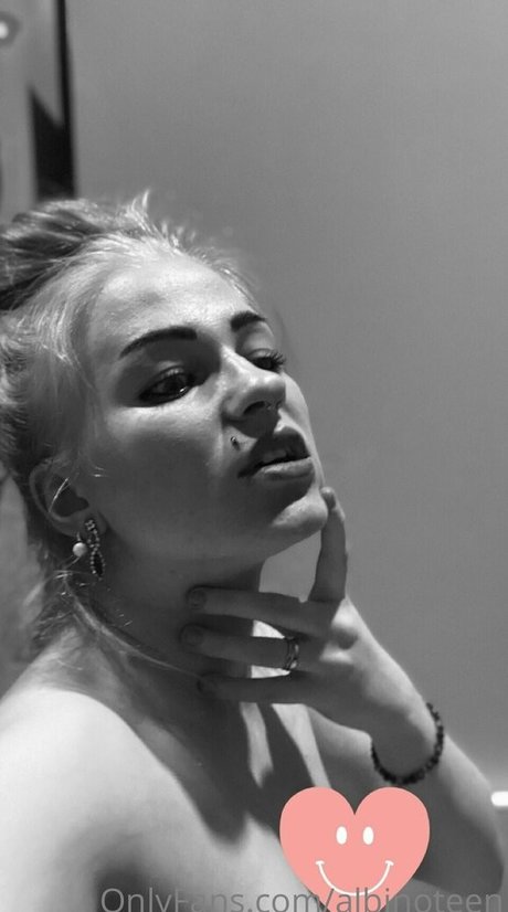 albinoteen onlyfans strip