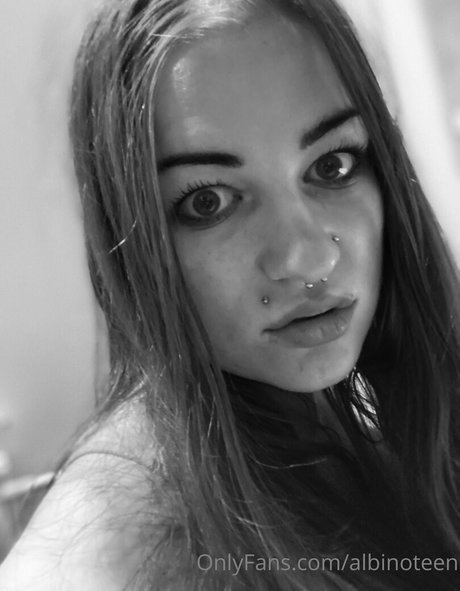 albinoteen onlyfans model images