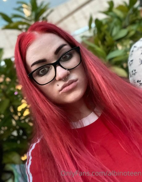 albinoteen only fans leaked