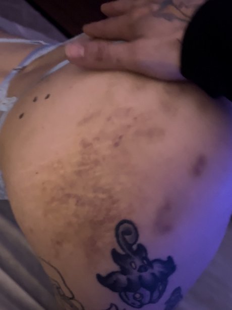 Birth defect onlyfans leaked porn