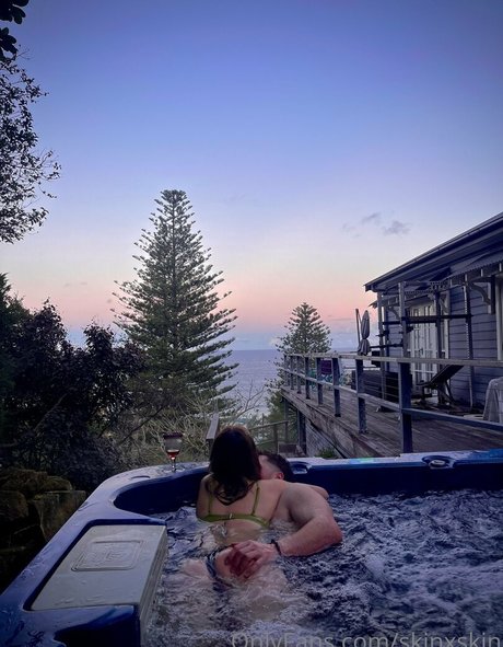 skinxskin onlyfans porn