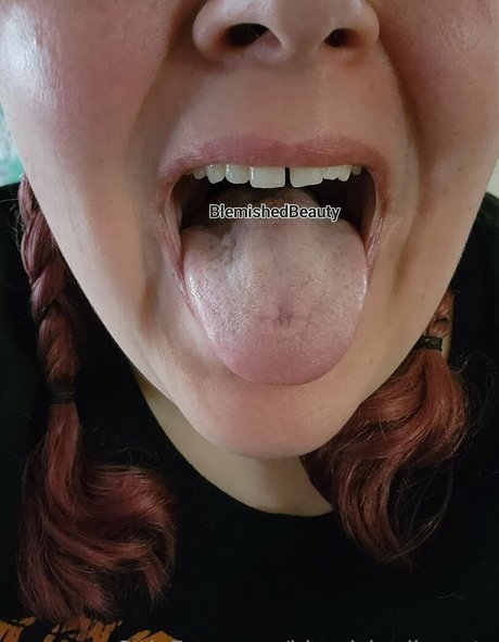 blemishedbeauty onlyfans free content