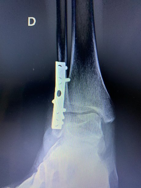 skinny model onlyfans erotic images