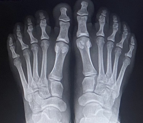 BBfeet nice star gallery