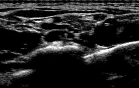 kacenna top actress archive