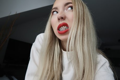 Kate in Braces sexy star photo