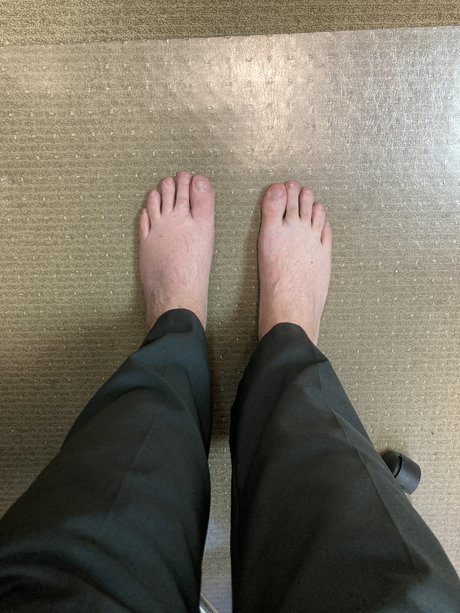 Baldguy best actress picture