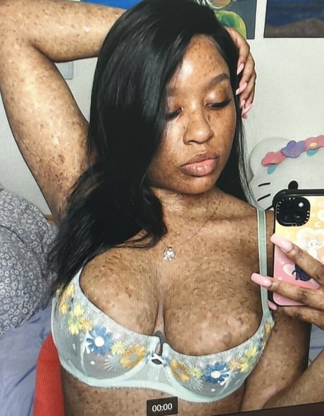 freckledn erotic pornstar image