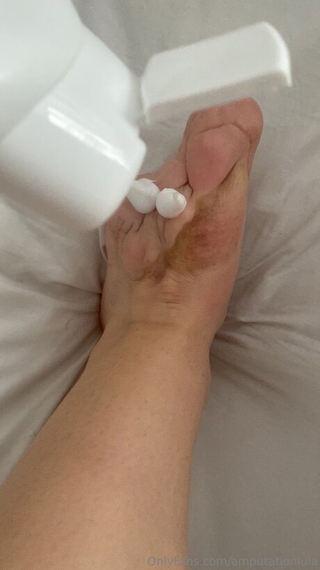 Amputationlula pornstar nude galleries