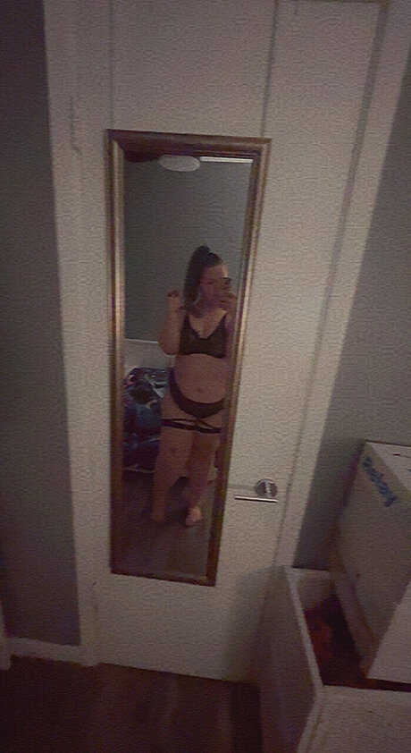 Scar perfect star gallery