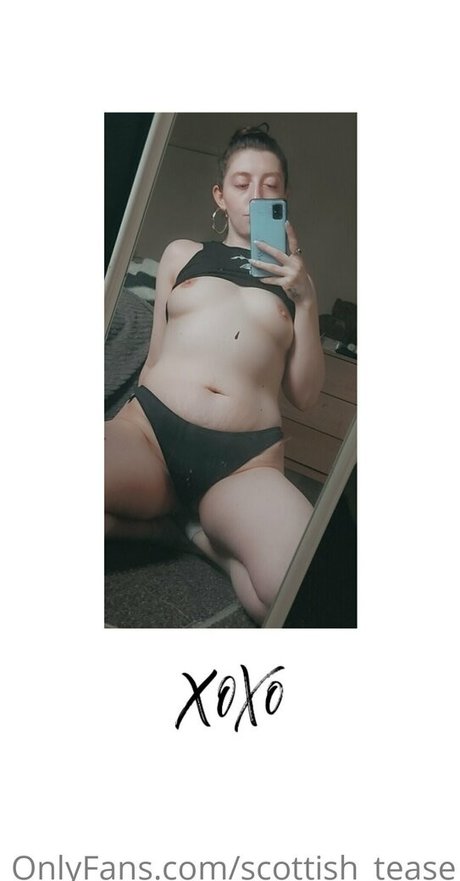 scottish tease nudes actress pic