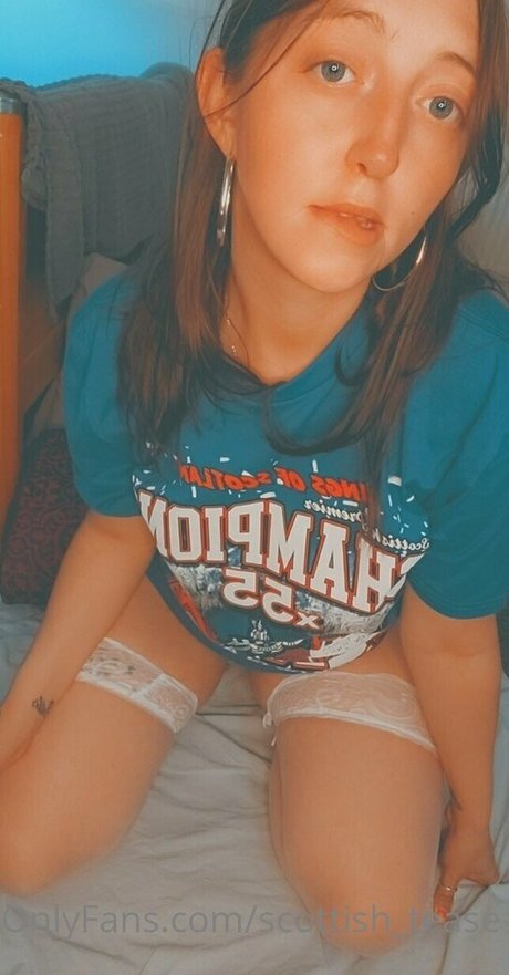 scottish tease perfect star pictures