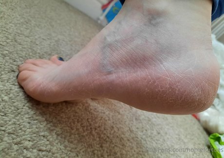 homefortoes model erotic image