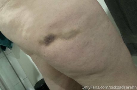 sicksadsarahh star best photo