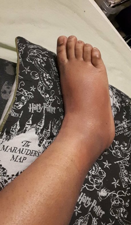 sillytilly star beautiful pic