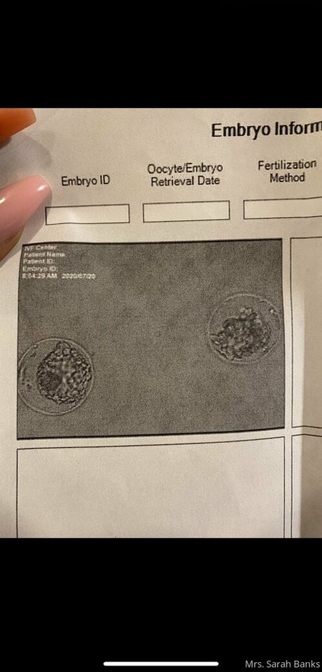 streamer onlyfans free sexy pic